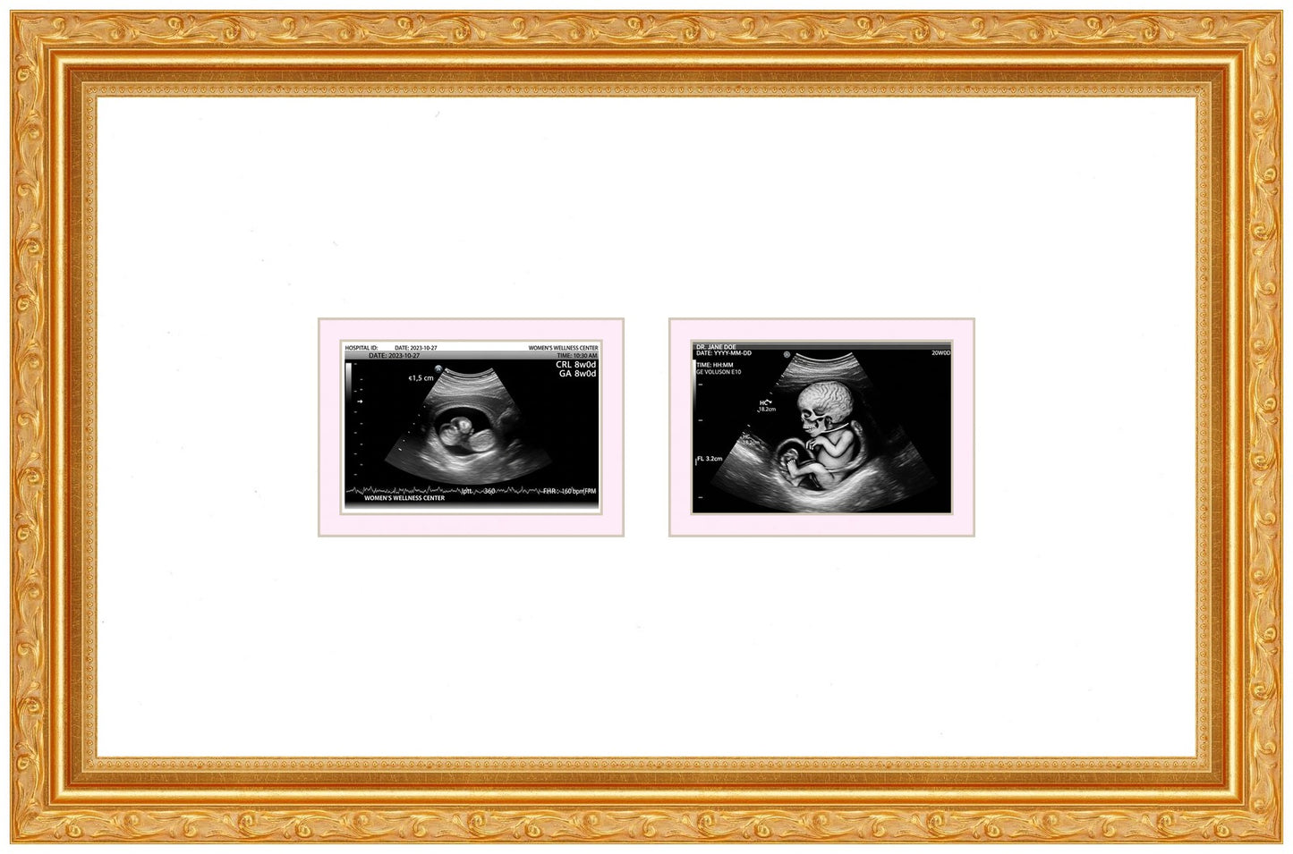 Double Sonogram Frame (Style 1) - corner and profile view