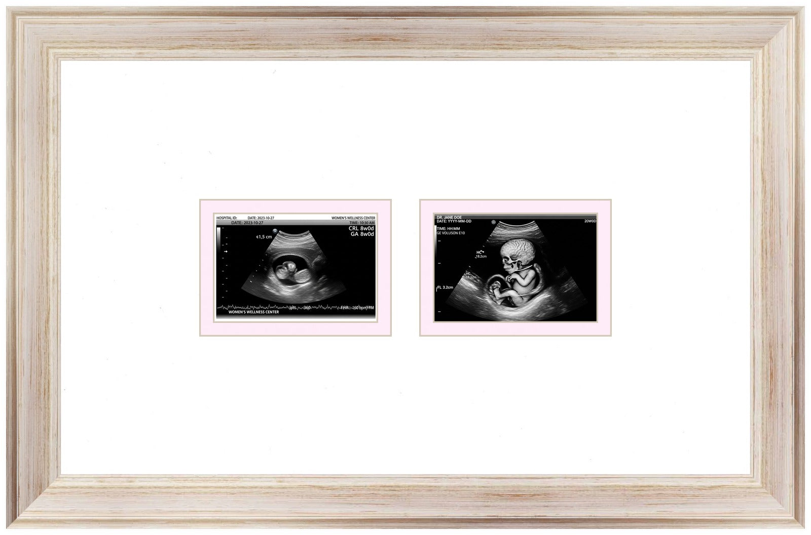 Double Sonogram Frame (Style 3) - corner and profile view