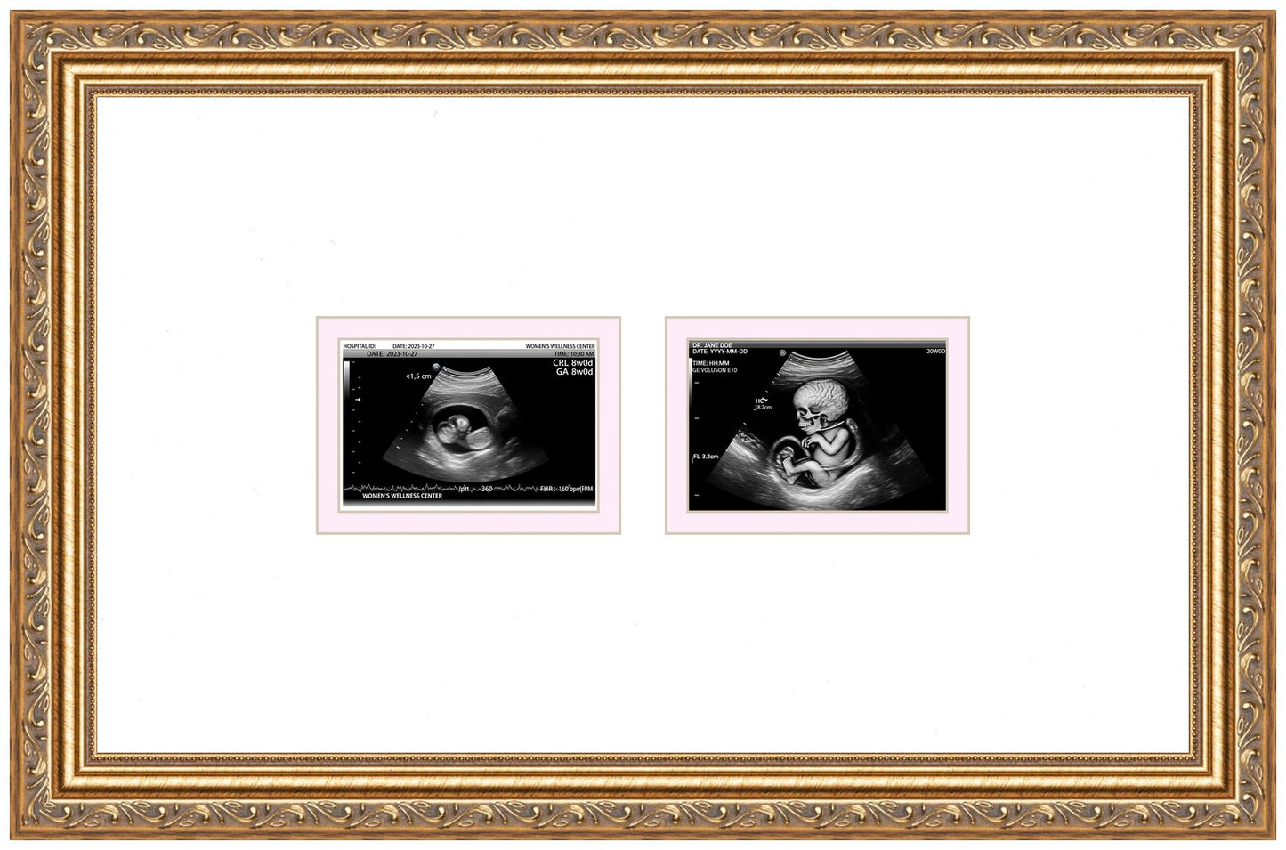 Double Sonogram Frame (Style 4) - corner and profile view