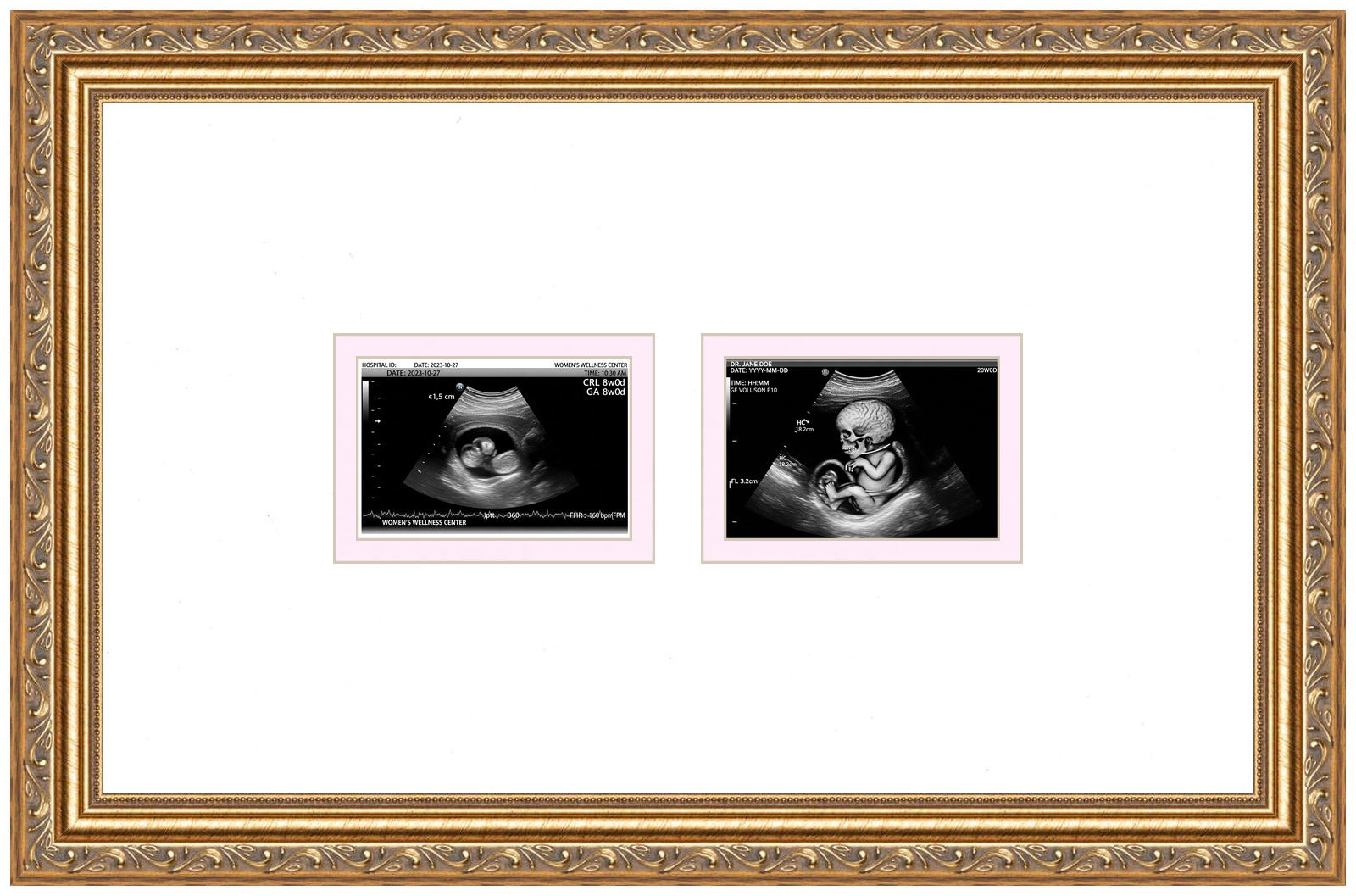 Double Sonogram Frame (Style 4) - corner and profile view