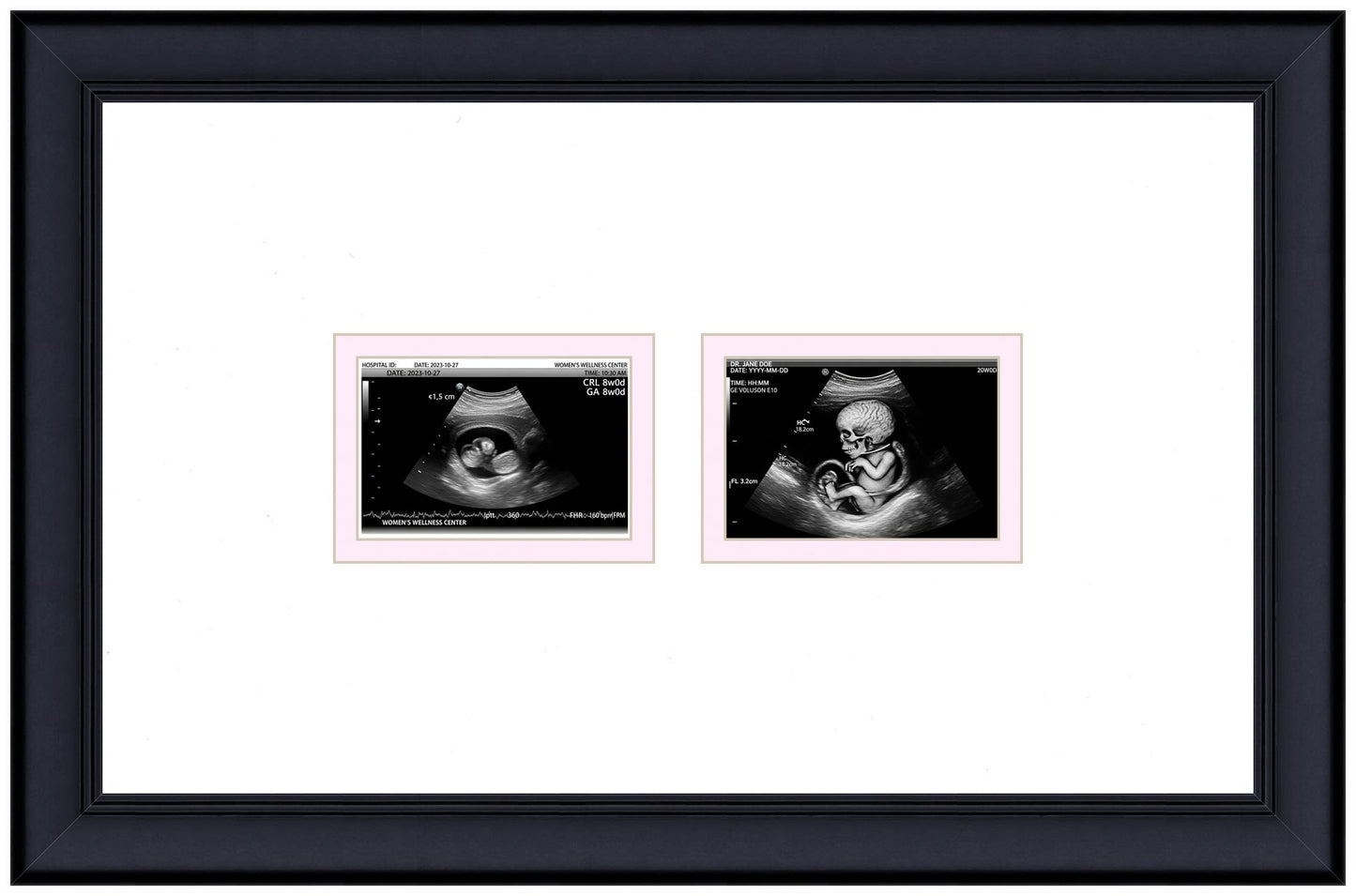 Double Sonogram Frame (Style 5) - corner and profile view