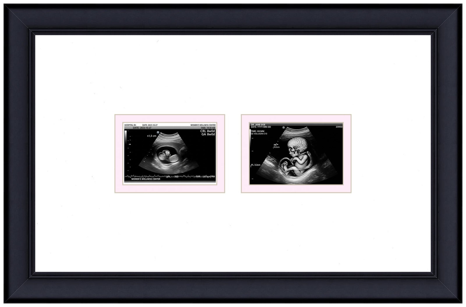 Double Sonogram Frame (Style 5) - corner and profile view