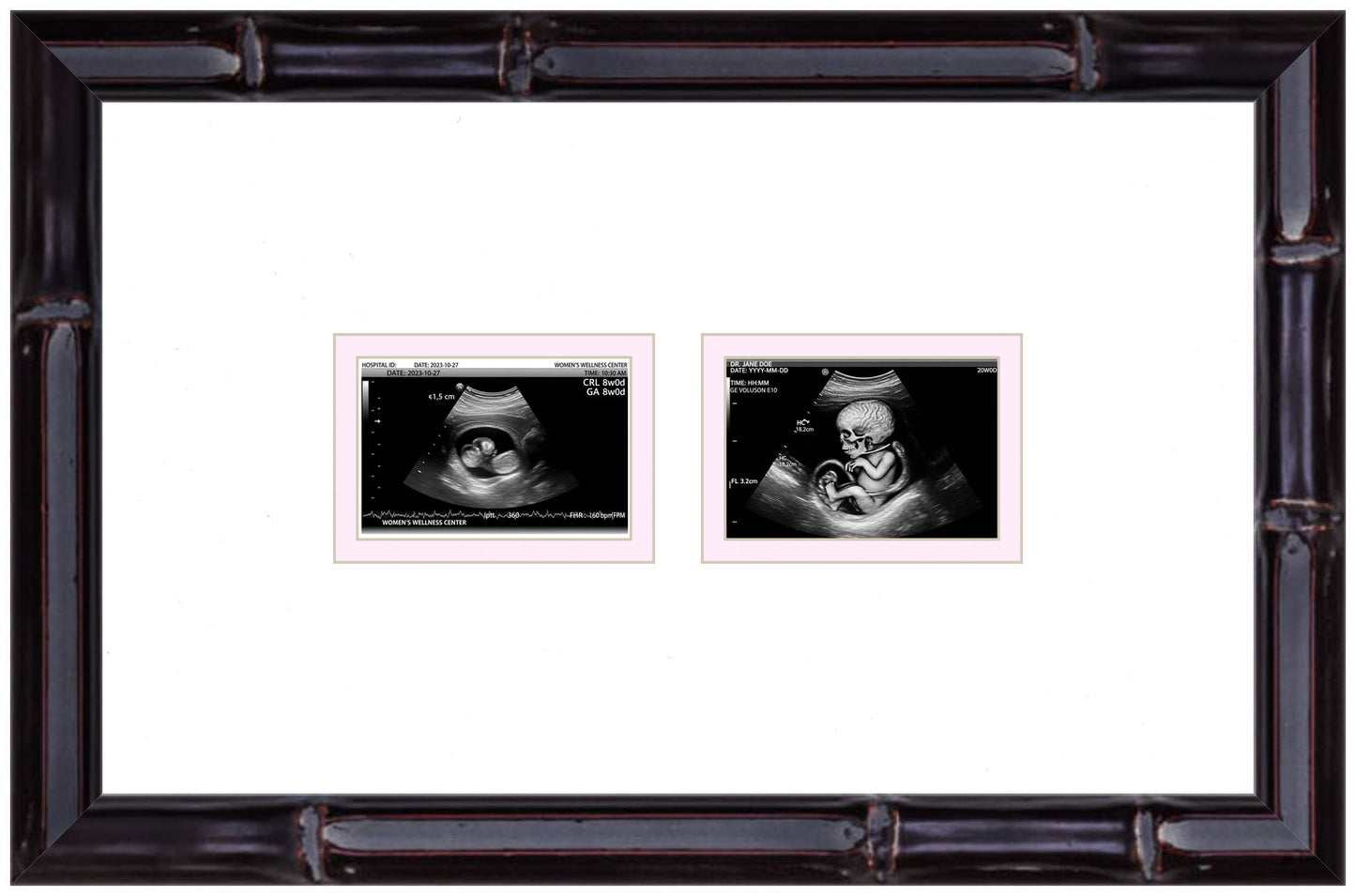 Double Sonogram Frame (Style 6) - corner and profile view