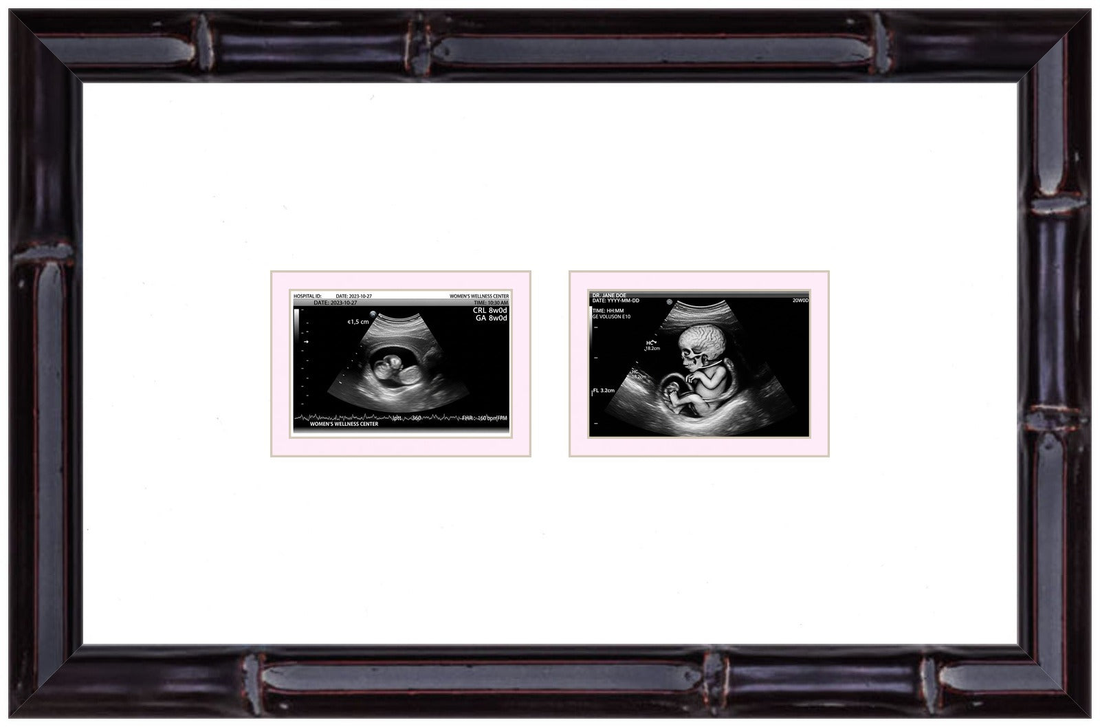 Double Sonogram Frame (Style 6) - corner and profile view