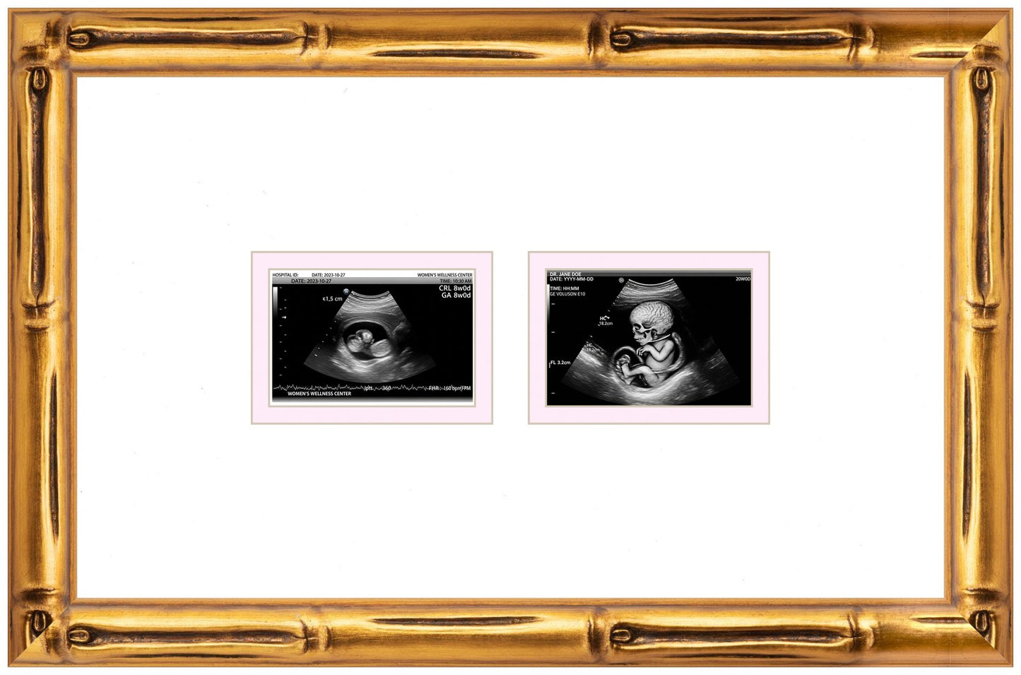 Double Sonogram Frame (Style 7) - corner and profile view