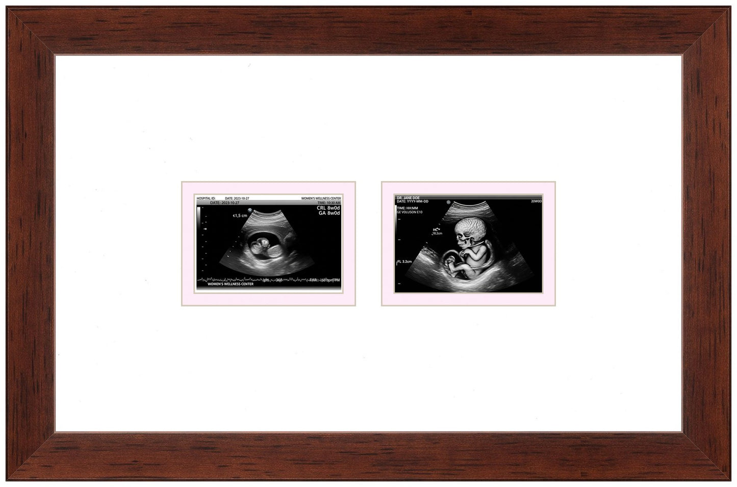 Double Sonogram Frame (Style 9) - corner and profile view