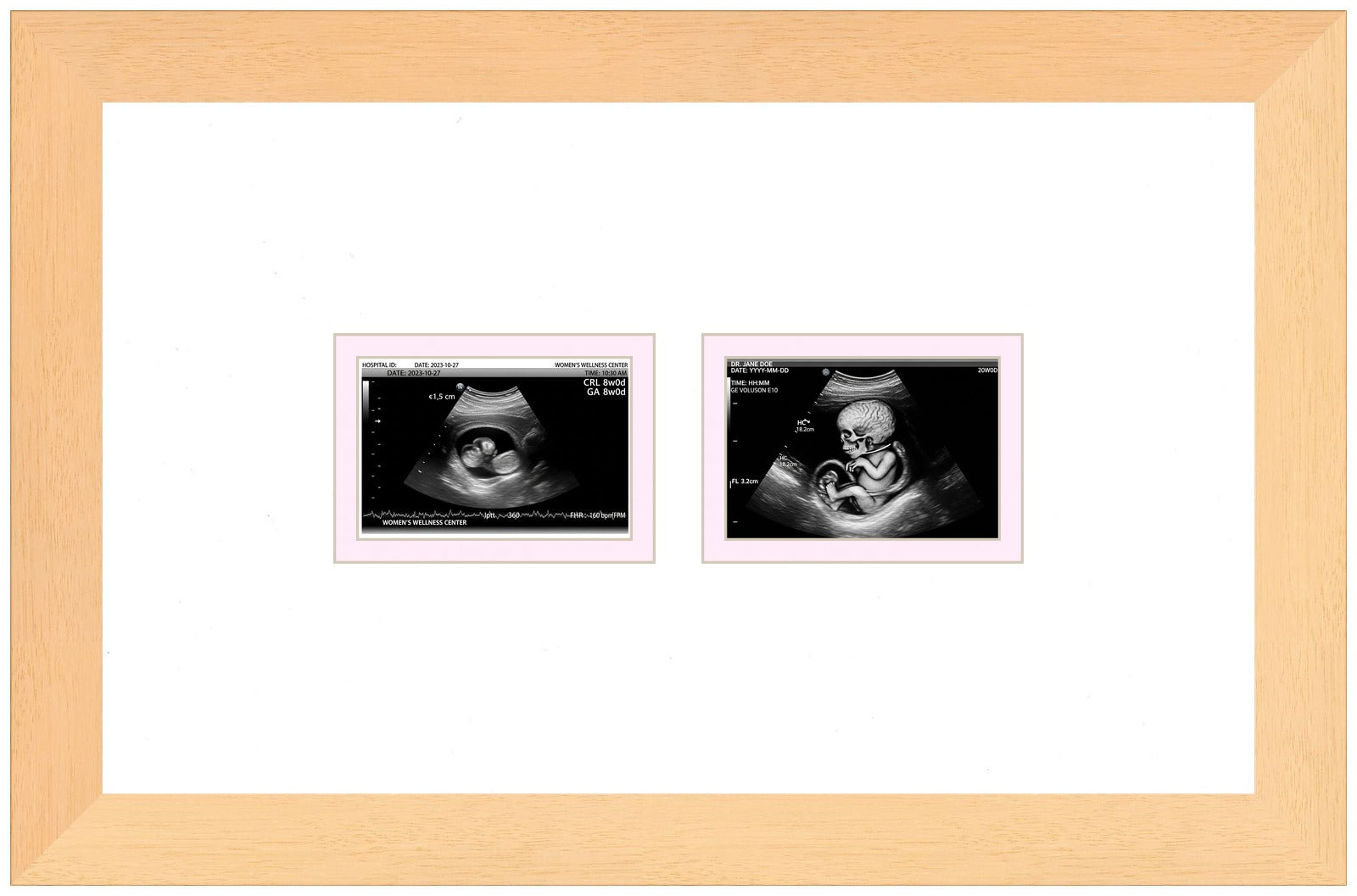 Double Sonogram Frame (Style 10) - corner and profile view