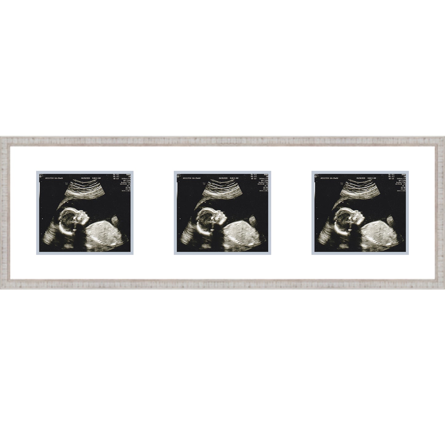 Double Sonogram Frame (Style 2) - corner and profile view