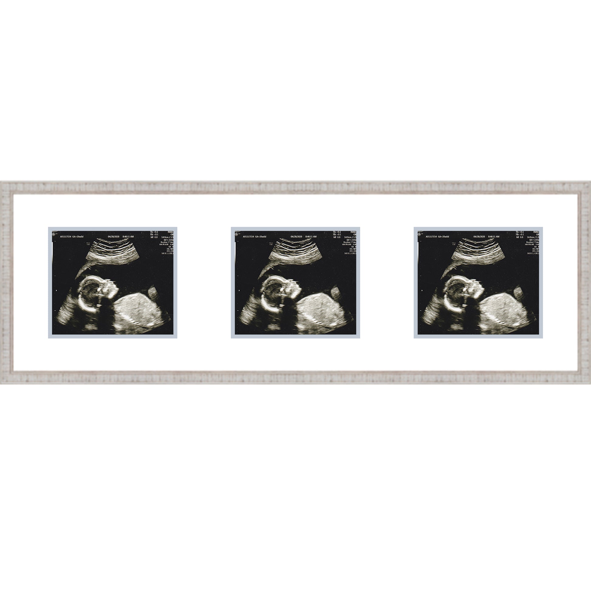 Double Sonogram Frame (Style 2) - corner and profile view