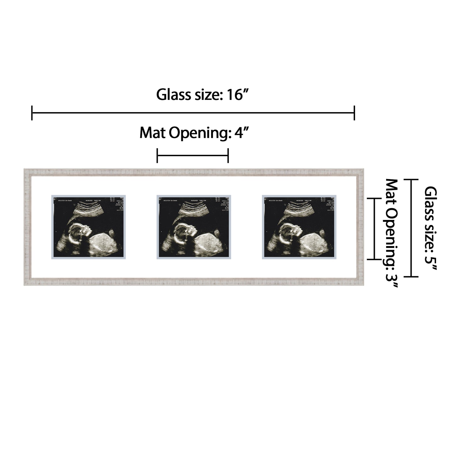 Double Sonogram Frame (Style 2)