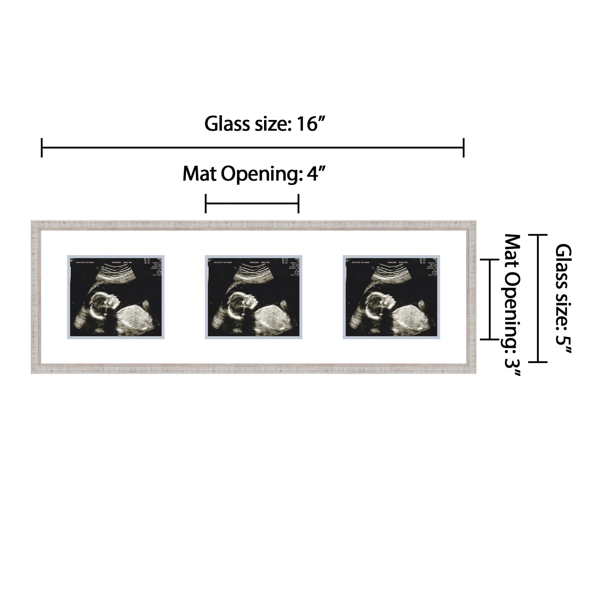 Double Sonogram Frame (Style 2)