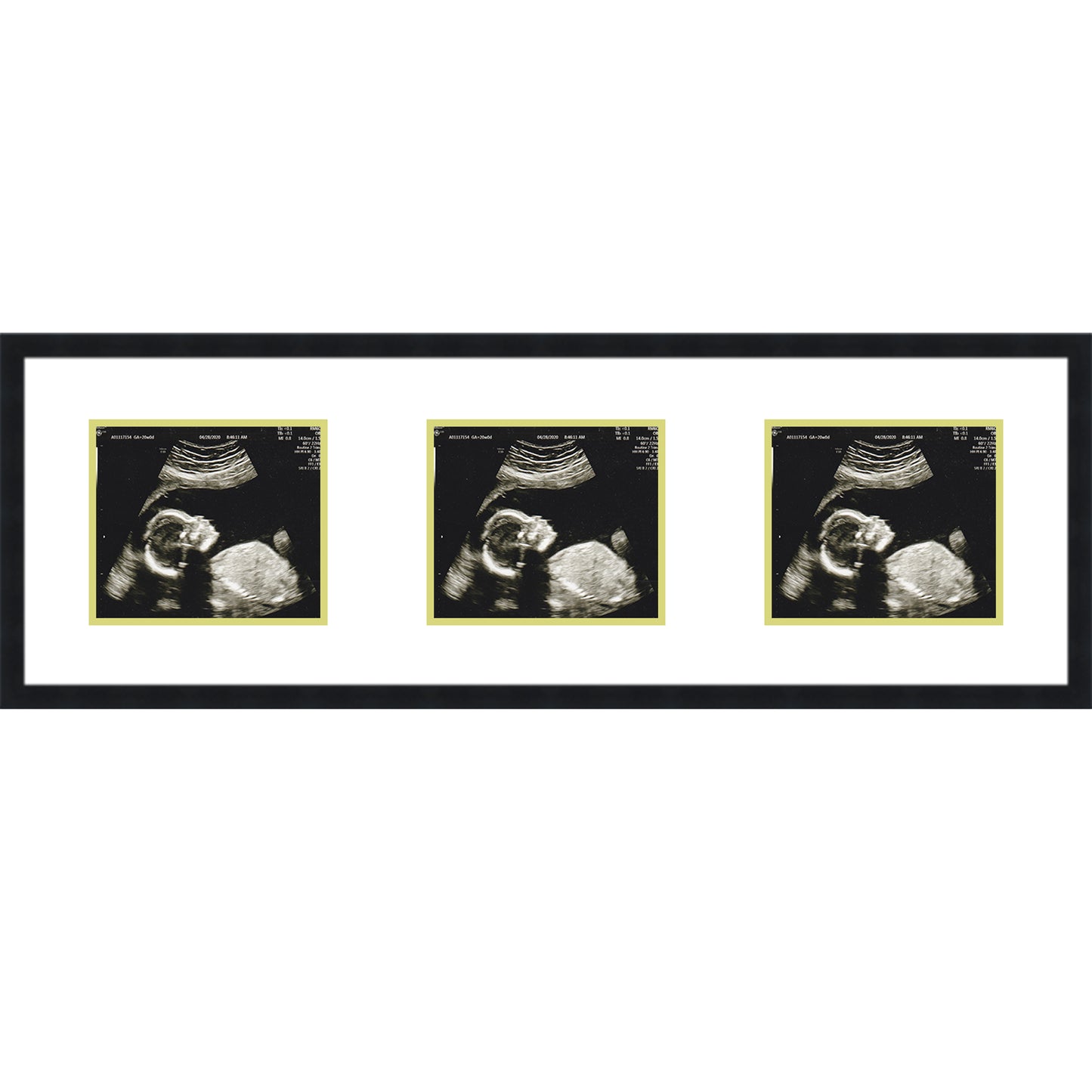 Double Sonogram Frame (Style 8) - corner and profile view