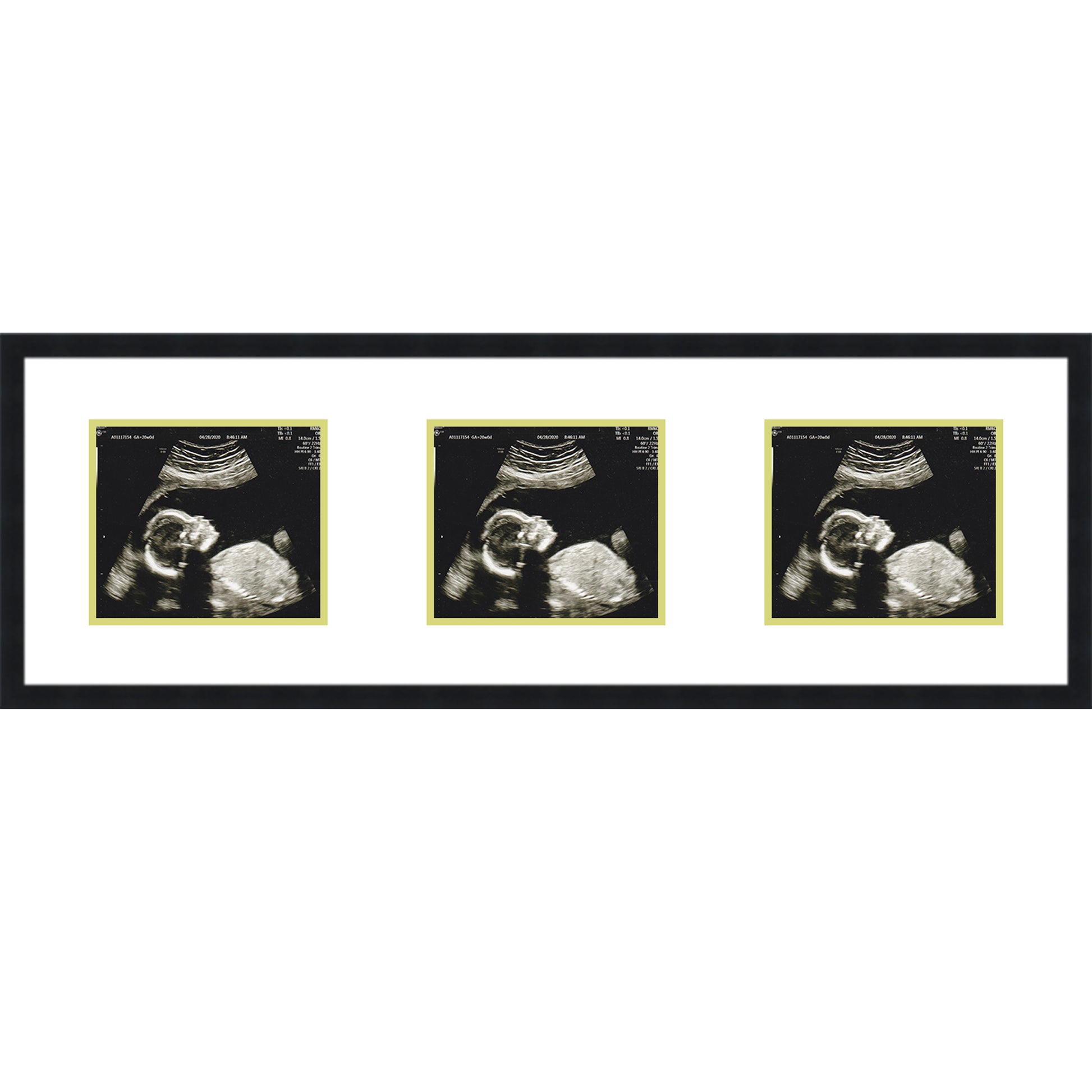 Double Sonogram Frame (Style 8) - corner and profile view