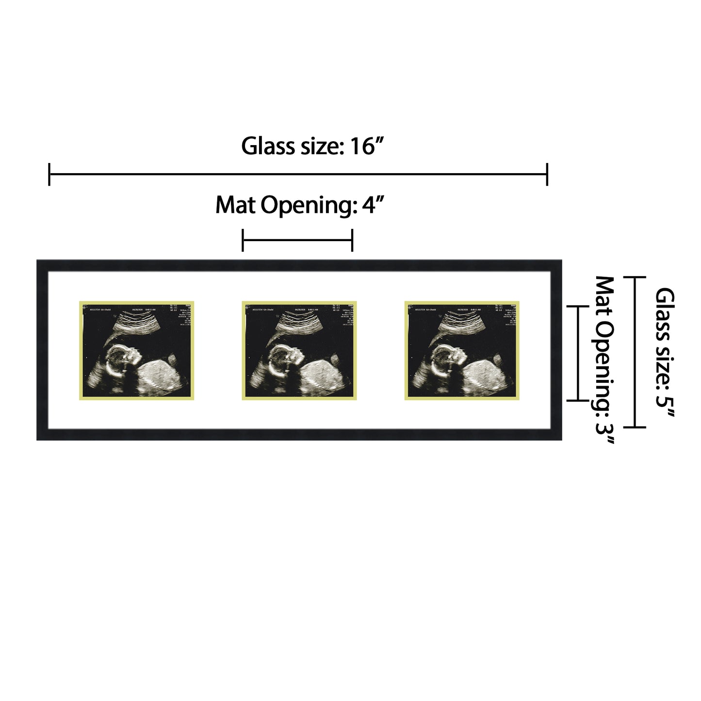 Double Sonogram Frame (Style 8)
