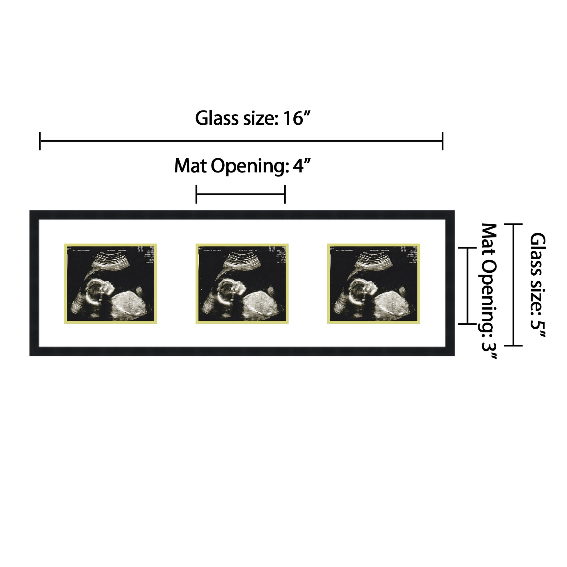 Double Sonogram Frame (Style 8)