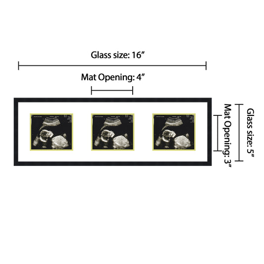 Double Sonogram Frame (Style 8)
