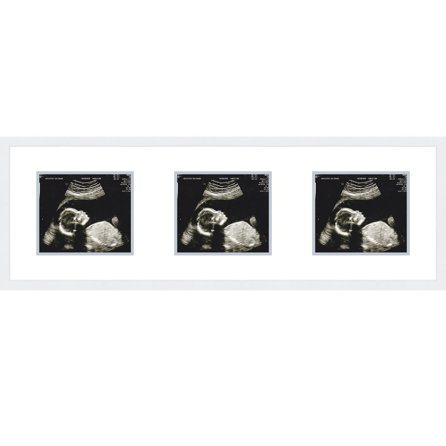 Double Sonogram Frame (Style 11) - corner and profile view