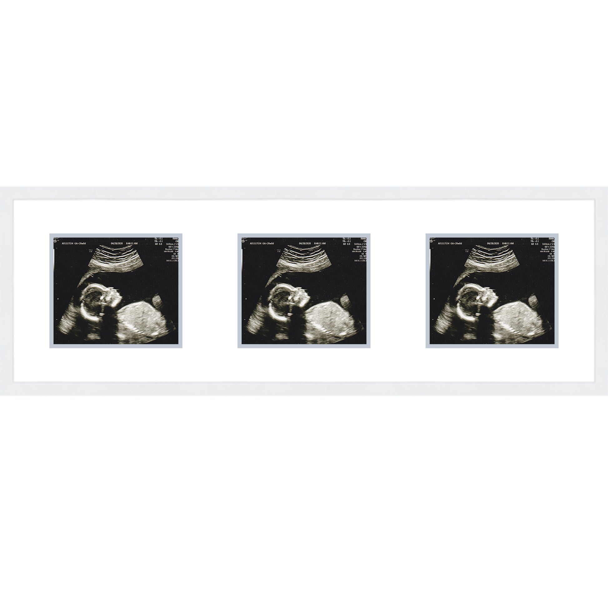 Double Sonogram Frame (Style 11) - corner and profile view