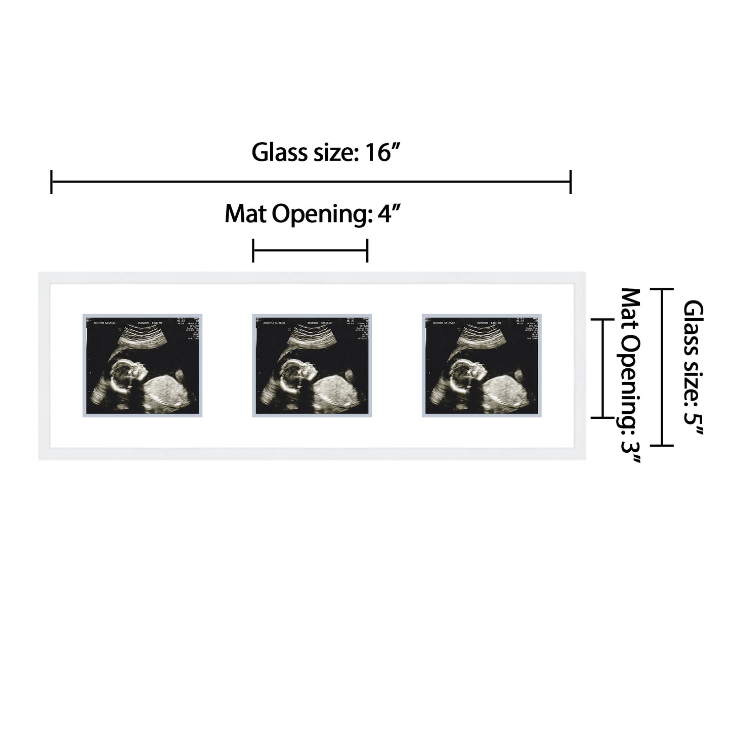 Double Sonogram Frame (Style 11)