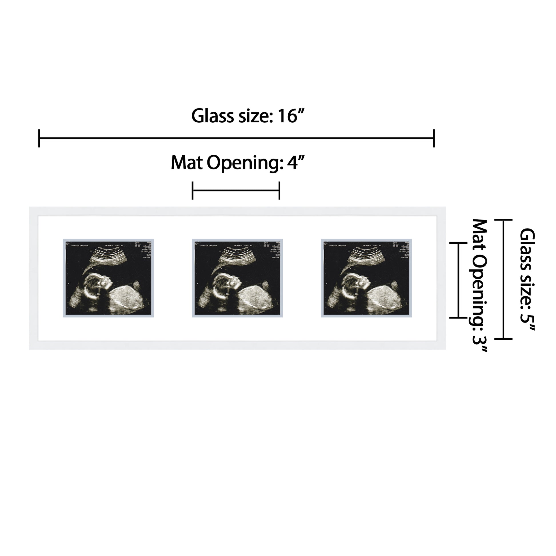 Double Sonogram Frame (Style 11)