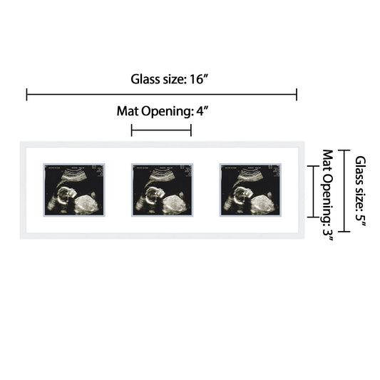 Double Sonogram Frame (Style 11)