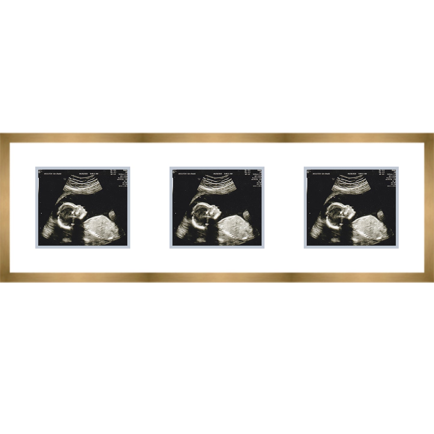 Double Sonogram Frame (Style 12) - corner and profile view