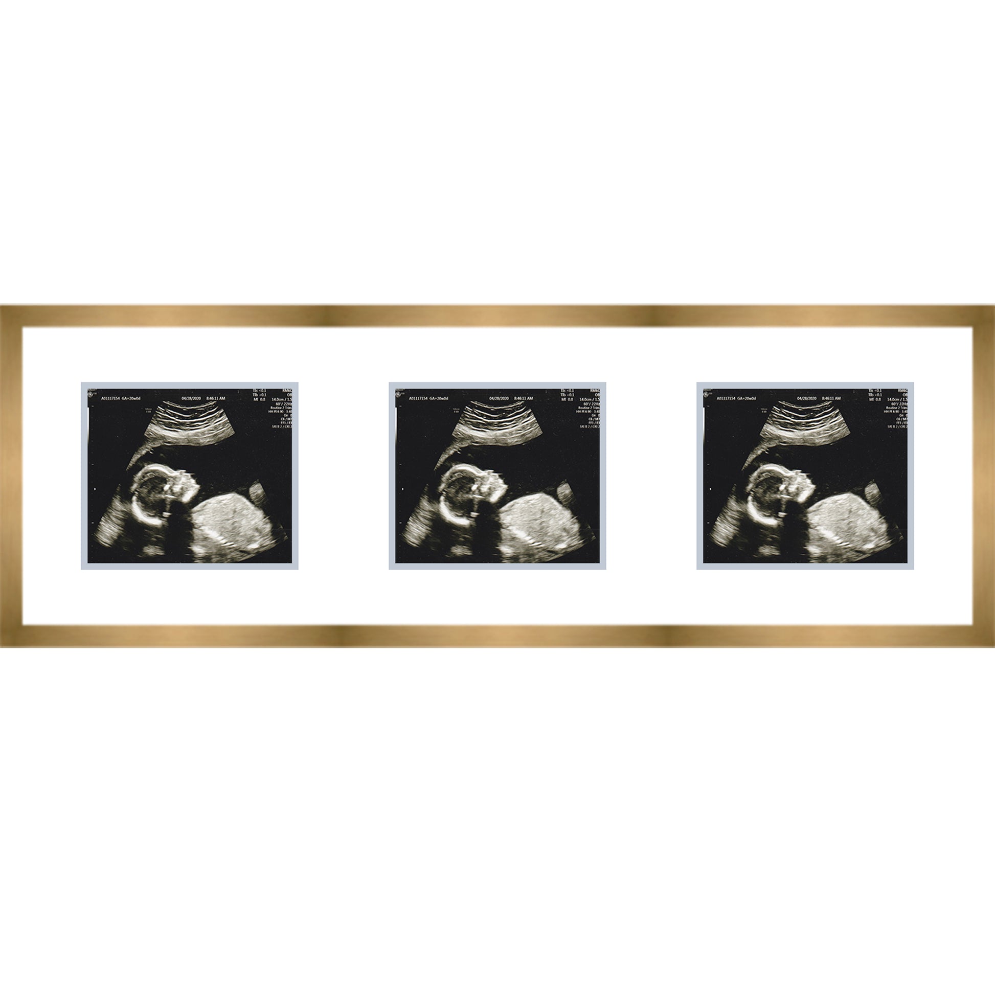 Double Sonogram Frame (Style 12) - corner and profile view