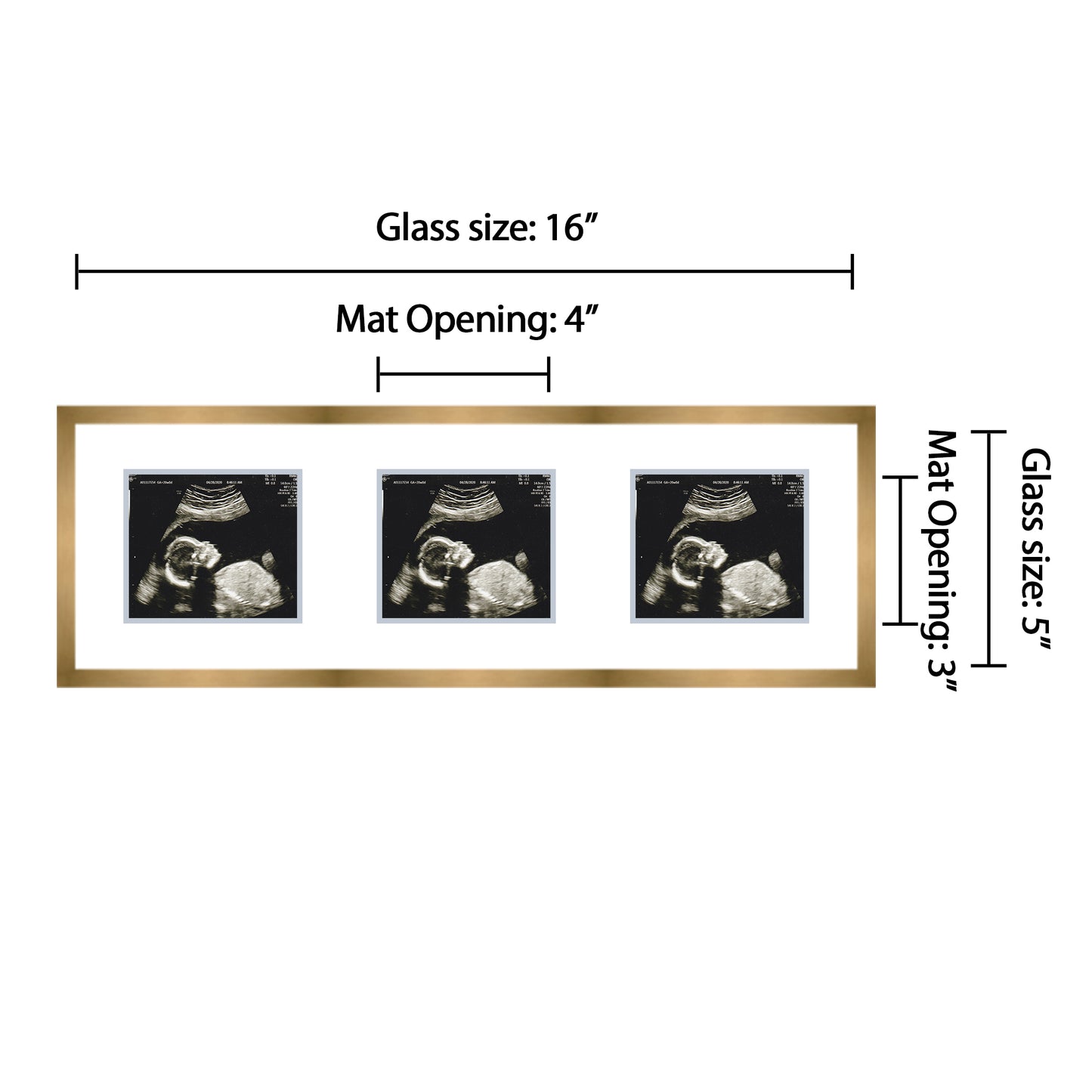 Double Sonogram Frame (Style 12)