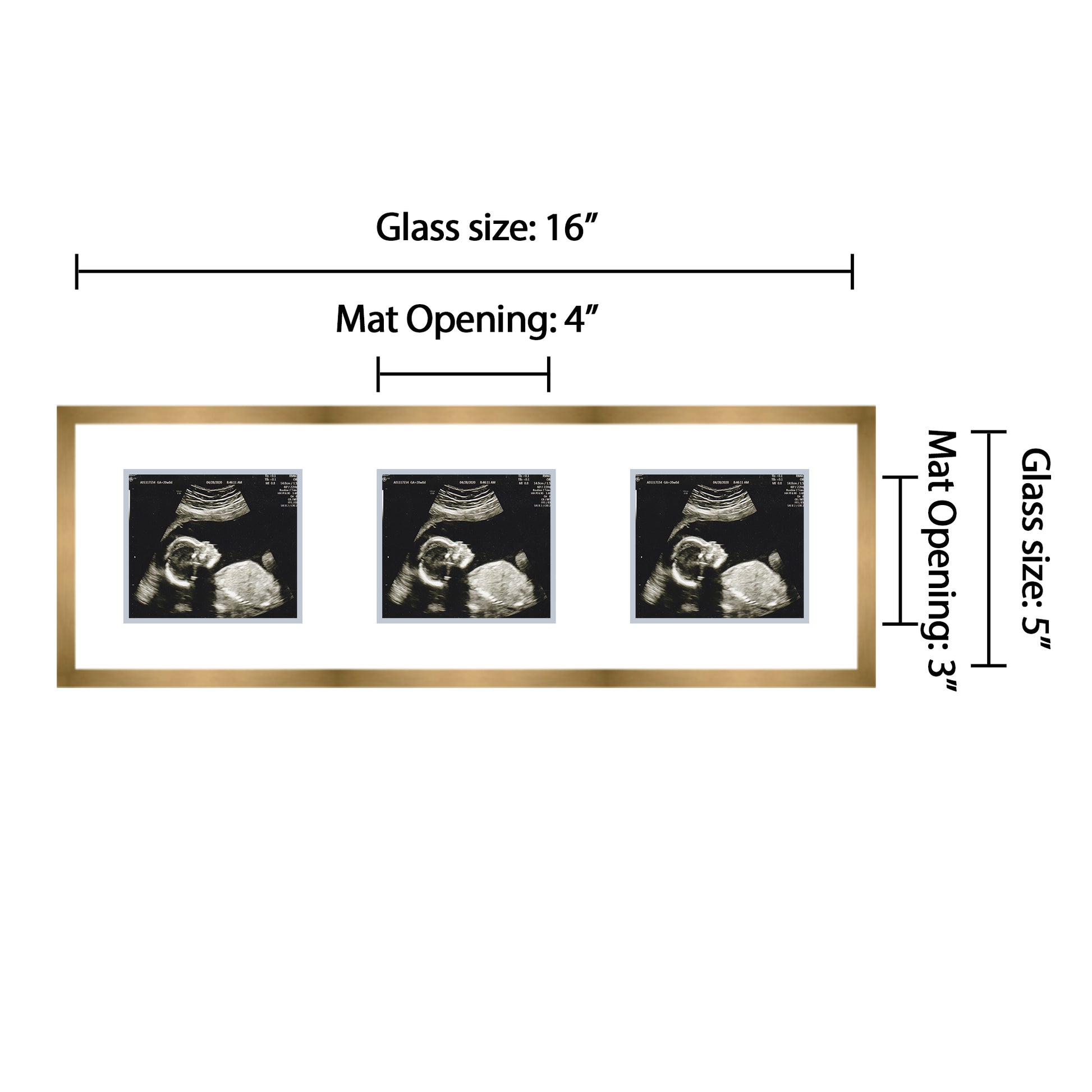 Double Sonogram Frame (Style 12)