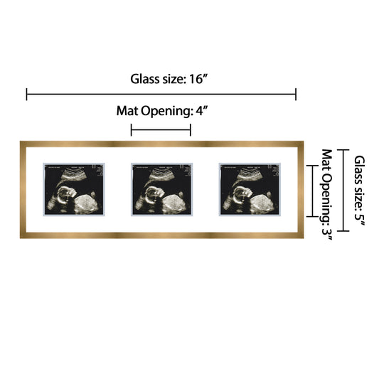 Double Sonogram Frame (Style 12)