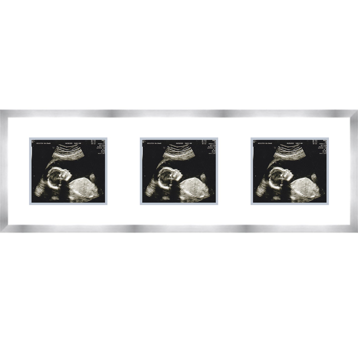Double Sonogram Frame (Style 13) - corner and profile view