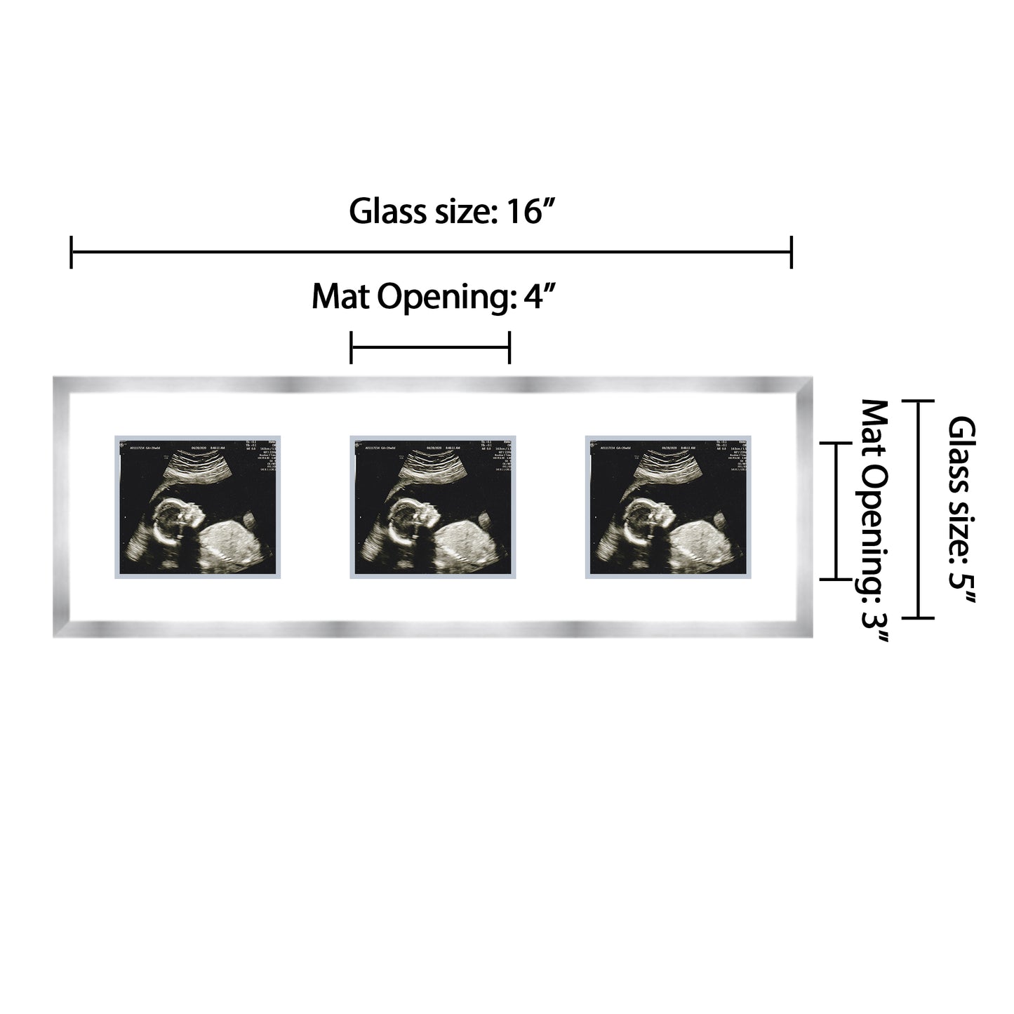 Double Sonogram Frame (Style 13)
