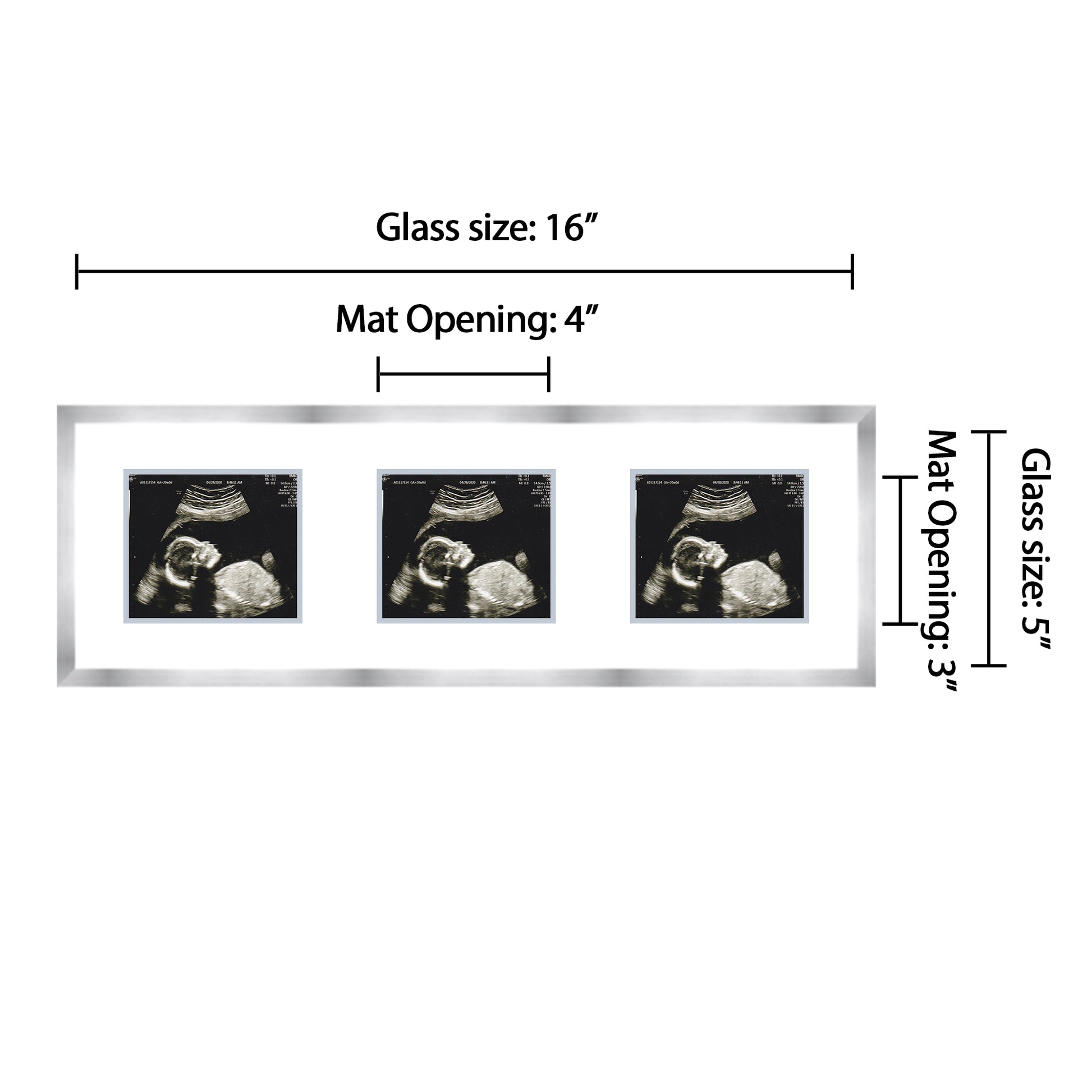 Double Sonogram Frame (Style 13)